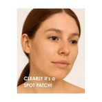 Stopever Clearly Spot Patch, Sivilce Karşıtı Şeffaf Plaster | Şeffaf, Ultra Ince, Hidrokolloid + Niacinamide + Salicylic Asit Içerikli Akne Karşıtı Yüz Bandı | 24 Adet - standart