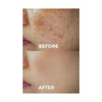 TeknoKapsül The Ceel Karşıtı Cilt Tonu Eşitleyen Cilt Serumu, Glutatyon & Niacinamide Etkili 30 ml