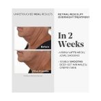 Uray Home Retinal Resculpt Overnight Treatment Retinal Içeren Yenileyici Gece Serumu, 30 ml - Option-1