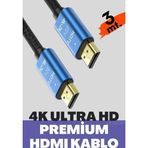 Vetech 4K Hdmı Kablosu Hdtv 2.0V 3Mt. Oyuncu Bilgisayarı, Playstation, Xbox, Notebook İçin