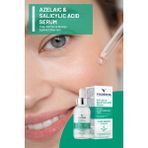 Viaderma Azelaik ve Salisilik Asit Serum 30 ml Yağlı Eğilimli Ciltler İçin Akne Karşıtı Etki