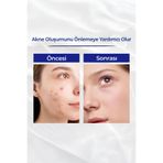 Vitamin A Yaşlanma ve Kırışıklık Karşıtı Retinol Krem 50 g 313-3