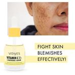 Vitayes C Vitamini%10 Panthenol Cilt Tonu Eşitleyici Karşıtı Aydınlatıcı Nemlendirici Serum, 30 Ml