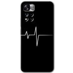 Xiaomi Redmi Note 11 Pro Plus 5G Heart Rytm Baskılı Uyumlu Silikon Kılıf