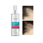 yelvas Procapil 5% Ve Saw Palmetto Içerikli Saç Dökülmesine Karşı Sprey (SERUM) 100 ml