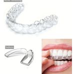 Ynt İthalat 515 Bruksizm Gece Aparatı Plağı