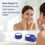 Zdrave Sivilce, Siyah Nokta ve Leke Kremi - Bulgar Kremi Nemlendirici Bakım Kremi 30GR Cilt Bakım Kremi - 30 GR
