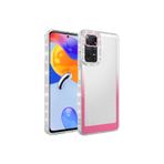 Zipax Xiaomi Redmi İle Uyumlu Note 11 Pro 5G Kılıf Simli Ve Renk Geçişli Kapak Zr Park Rd Nt Beyazpembe