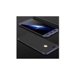 Zore Xiaomi Mi 5X Ays Kılıf