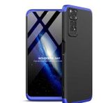 Zore Xiaomi Redmi Note 11 Global Ays Kapak Kılıf