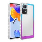 Zore Xiaomi Redmi Note 11 Pro 5G Simli ve Renk Geçiş Tasarımlı Lens Korumalı Park Kapak Kılıf