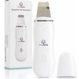 1001 Ultrasonik Cilt Temizleyici Skin Scrubber W-1188, Siyah Nokta ve Gözenek Temizleme Cihazı, 24.000
