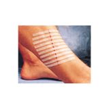 3M Steri-strip Dikiş Bantı 12 Mm X 100 Mm 6 Şerit R-1547 ( 5 Adet )