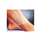 3M Steri-Strip Dikiş Bantları 12Mm X 100Mm 6 Adet Şerit R1547 3 Adet