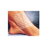 3m Steri-Strip Dikiş Bantları 6mm X 100mm 10 Adet Şerit R1546