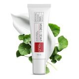 40 Ml Akne Kremi - Salisilik Asit Ve Niasinamid İle Leke Giderici