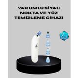 5 Kademeli Vakumlu Gözenek Temizleyici – Su Geçirmez Ve Taşınabilir Siyah Nokta Cihazı FRTKGT25DYMXUCZZZSİYAHNOOKTACİHAZIIIII-1