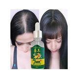7Days 30ML Gingergerminalessentialoil Hair Growth Loss Treatment Serum Unisex 3 Adet Saç Bakım Yağı