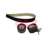 a.b.a YK851116 Trıger Eksantrık Gergı Setı 308 407 807- 308 3008- 5008 Rcz Expert Iıı Jumpy Iıı C8 807 C5 Iıı C4 Pıcasso DW10CTED4 2.0hdı 16V 116 Dıs Kayıs