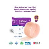 Advancis Medical UK Siltape Soft Silikon Bant - Yanık Sezaryen Dikiş Izi Keloid Ameliyat Izi Giderici 4cmx1,5mt