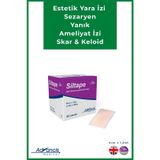 Advancis Medical UK Siltape Soft Silikon Yara İzi Dikiş İzi Sezaryen Yanık Estetik Bant 4 CM x 1500 CM