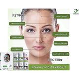 Aesco 50 ml Soğuk Sıkım Hint Yağı, Besleyici ve Nemlendirici