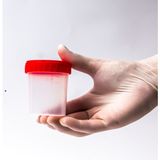Aklab Group Düz Idrar Kabı 100 ml Steril 50 Adet Hafif ve Dayanıklı Medikal Ürün