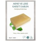Akne, Sivilce ve Leke Karşıtı Doğal El Yapımı Sabun – 115 gr