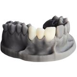 Alias Dental Model Reçinesi 1 Kg LCD 3d yazıcılarla Uyumlu, UV, Fotopolimer Reçine (Gri)