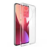 Ally Xiaomi 12 Pro Kılıf Kamera Korumalı Ultra İnce Şeffaf Silikon Kılıf