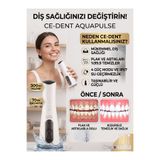 alpkan Ce-Dent AquaPulse Şarjlı Ağız Duşu 300 ml - Taşınabilir Diş Temizleme Cihazı, Diş Teli Uyumlu Tartar Plak Temizleyici + 4 Başlık