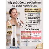 Alpkan Ce-Dent Aquapulse Taşınabilir Şarjlı Ağız Duşu 300 ml - 4 Kademeli Diş Temizleme Cihazı, Diş Teli ve Implant Uyumlu Plak Tartar Temizleyici Su Püskürtücü + 4 Başlık Ağız Duşu Beyaz