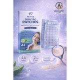 Alright 44 Adet Et Beni Bandı Cilt Bakım Seti Skin Tag Remover Pratik Kullanım