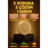 Anatolia Soap Aloe Vera Nane Fesleğen Sabunu