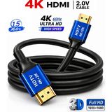 Anktek 4K HDMI 2.0 Kablo 60 Hz 3D Ultra Hd 18 Gpbs Yüksek Hız ve Netlikte Aktarır (1.5 Mt) - 1.5Mt