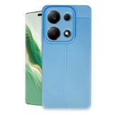Anonim Newface Xiaomi Redmi Note 13 Pro 4G Kılıf Auto Focus Kapak - Mavi