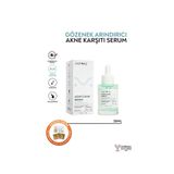 Anyong 30 ML Sivilce Karşıtı Serum