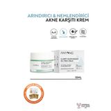 Anyong Sakinleştirici ve Nemlendirici Yağ İçermeyen Krem 50 ml (Centella Özü & Hyalüronik Asit)-Yağlı Cilt