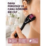 Aparim Dermaroller Titanyum 540 Iğneli 1 mm Cilt Yenileme ve Anti Aging Etkisi