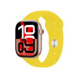 Apple iPhone 12 Uyumlu Sarı Akıllı Saat Watch10 2025 Hediyeli AMOLED EKRAN
