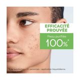 Asseds Store Jonzac Pure Akneye Eğilimli Yağlı Ciltler Için Organik Arındırıcı Maske 50 ml - Option-1