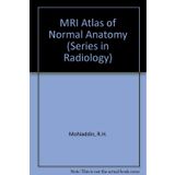 Atlas of Normal Anatomy MRI: 64