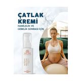Aura Care Çatlak Karşıtı Krem (Hamilelik ve Gebelik Sonrası Çatlaklar İçin)