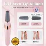 Ayak ve Topuk Törpüsü Şarjlı Ayak Pedikür Aleti Ayak Bakım Törpüsü Pürüsüzleştirici Ölü Deri Atıcı Törpü Kırmed
