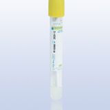 Ayset Vakumlu Kan Alma Tüpü 5 Ml 100 Adet