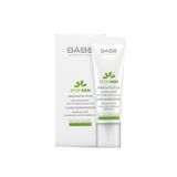 Babe Stop AKN Keratolytic Fluid 30 ml Sivilce Kremi