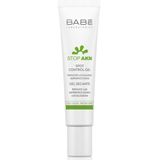 Babe Stop Akn Spot Control 8 ml Akne Kurutucu Stik