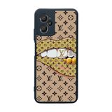 BG AKSESUAR Casper Via X30 Plus ile Uyumlu Kılıf, LouisVuitton Tasarım, Siyah, Yumuşak Silikon, Koruyucu, Şok Emici