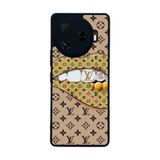 BG AKSESUAR Tecno Camon 30 Pro ile Uyumlu Kılıf, Yumuşak Silikon, Koruyucu, Şok Emici, Mat Siyah, LouisVuitton Desen
