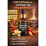 Biorganix Life Life %100 Saf Kuşburnu Çekirdeği Yağı 20 ml – Soğuk Sıkım & Cilt Yenileyici